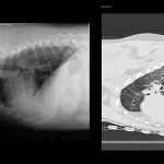 Bronchitis and pneumonia in dogs