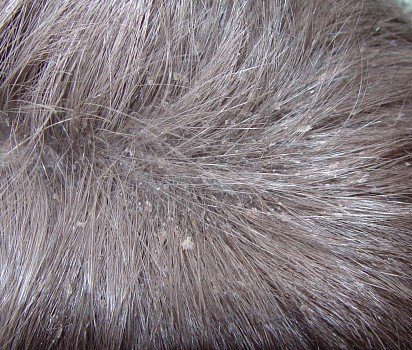 Dandruff in cats: causes, types, features of diagnosis, treatment and prevention