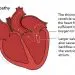 Stroke in a dog: symptoms and treatment