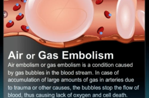 Gas embolism
