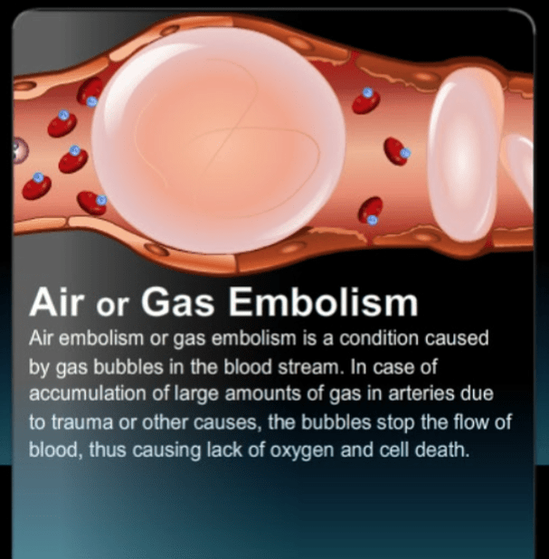 Gas embolism