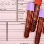 General and biochemical blood tests in cats: decoding, deviations, norms