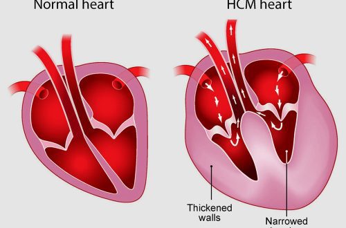 HCM in cats &#8211; hypertrophic cardiomyopathy