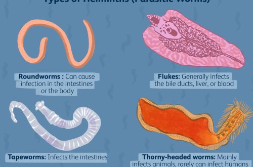 Helminthiases: roundworms, oxyurides and other worms
