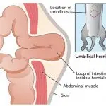 Hernia in cats