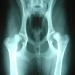 Hip dysplasia in dogs