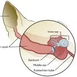 Otitis media in cats