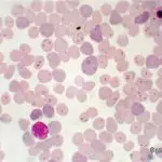 Piroplasmosis in cats