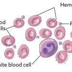 When can a dog get babesiosis?