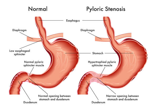 Pyloric stenosis in a dog: what is pyloric stenosis and how to get rid of it