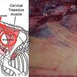 The head and neck of a horse. What do they have to do with balance?