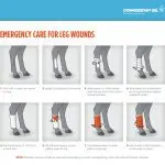 We bandage the horse’s legs: how and in what cases?