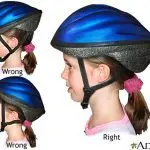 When a Helmet Fails: First Aid for a Head Injury